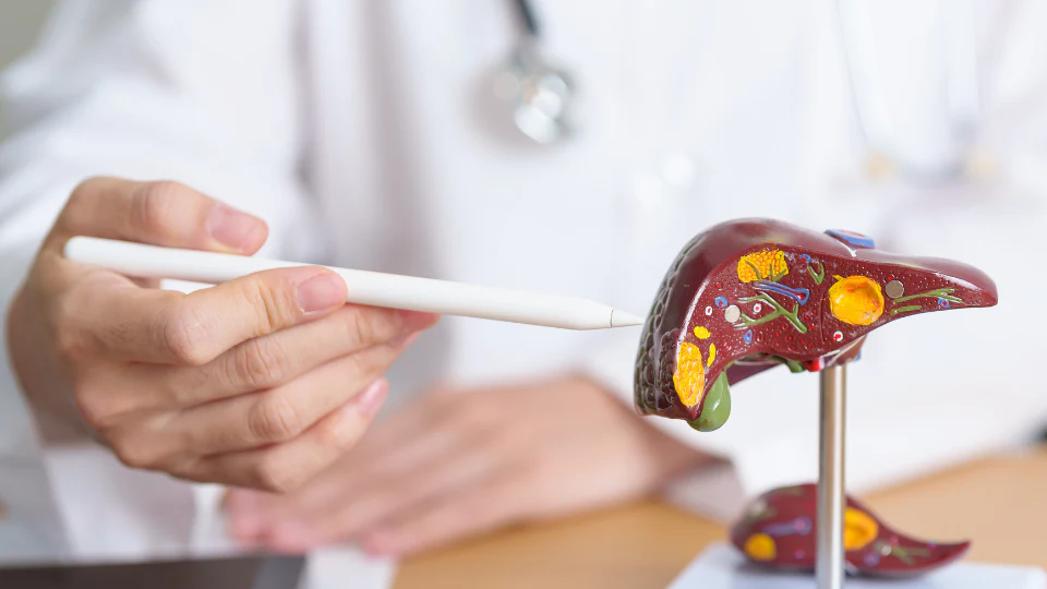 Ayurvedic perspective on non-alcoholic fatty liver disease and its management